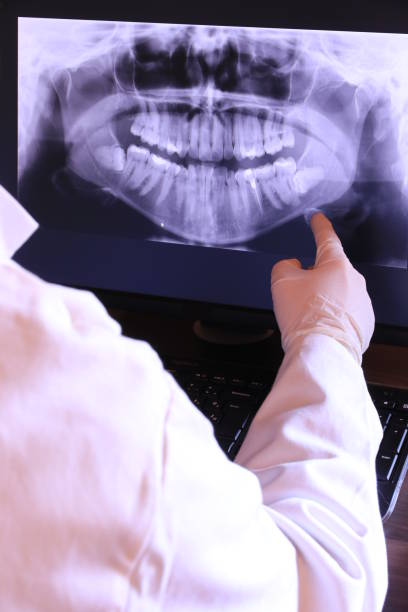 Best Emergency Tooth Extraction in Ivey, GA