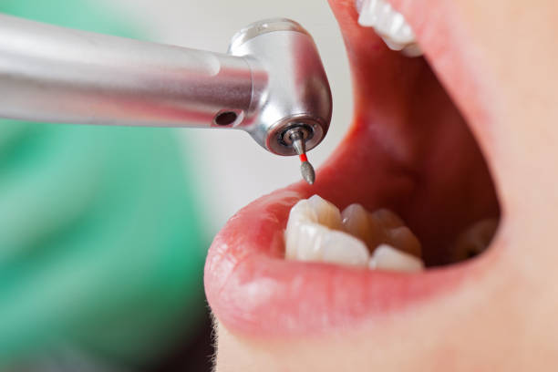 Best Same-Day Emergency Dental Services in Ivey, GA